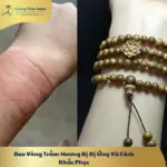 Đeo Vòng Trầm Hương Bị Dị Ứng Và Cách Khắc Phục